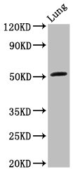 ARHGAP1 / CDC42GAP Antibody - Positive Western Blot detected in Rat lung tissue. All lanes: ARHGAP1 antibody at 3.2 µg/ml Secondary Goat polyclonal to rabbit IgG at 1/50000 dilution. Predicted band size: 51 KDa. Observed band size: 51 KDa