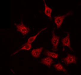 ARHGAP1 / CDC42GAP Antibody - Staining HeLa cells by IF/ICC. The samples were fixed with PFA and permeabilized in 0.1% Triton X-100, then blocked in 10% serum for 45 min at 25°C. The primary antibody was diluted at 1:200 and incubated with the sample for 1 hour at 37°C. An Alexa Fluor 594 conjugated goat anti-rabbit IgG (H+L) Ab, diluted at 1/600, was used as the secondary antibody.