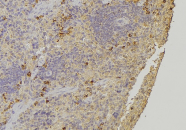 ARHGAP1 / CDC42GAP Antibody - 1:100 staining human lymph node tissue by IHC-P. The sample was formaldehyde fixed and a heat mediated antigen retrieval step in citrate buffer was performed. The sample was then blocked and incubated with the antibody for 1.5 hours at 22°C. An HRP conjugated goat anti-rabbit antibody was used as the secondary.