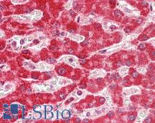 ARHGAP1 / CDC42GAP Antibody - Human Liver: Formalin-Fixed, Paraffin-Embedded (FFPE).  This image was taken for the unconjugated form of this product. Other forms have not been tested.