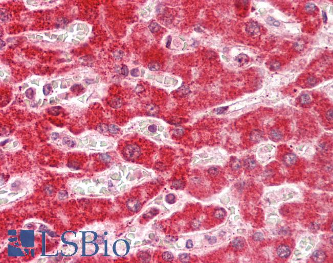 ARHGAP1 / CDC42GAP Antibody - Human Liver: Formalin-Fixed, Paraffin-Embedded (FFPE).  This image was taken for the unconjugated form of this product. Other forms have not been tested.