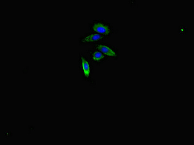 ARHGAP10 Antibody - Immunofluorescent analysis of HepG2 cells diluted at 1:100 and Alexa Fluor 488-congugated AffiniPure Goat Anti-Rabbit IgG(H+L)