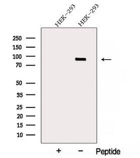 ARHGAP10 Antibody - Western blot analysis of extracts of HEK293 cells using ARHGAP10 antibody. The lane on the left was treated with blocking peptide.