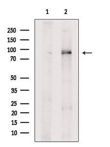 ARHGAP10 Antibody