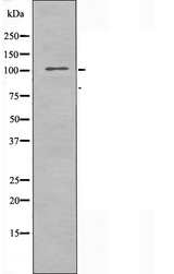 ARHGAP11A Antibody - Western blot analysis of extracts of NIH-3T3 cells using RHG11A antibody.