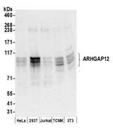 ARHGAP12 Antibody - Detection of human and mouse ARHGAP12 by western blot. Samples: Whole cell lysate (50 µg) from HeLa, HEK293T, Jurkat, mouse TCMK-1, and mouse NIH 3T3 cells prepared using NETN lysis buffer. Antibodies: Affinity purified rabbit anti-ARHGAP12 antibody used for WB at 0.1 µg/ml. Detection: Chemiluminescence with an exposure time of 30 seconds.