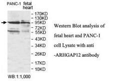 ARHGAP12 Antibody - Western blot of ARHGAP12 antibody