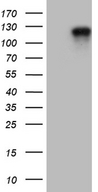 ARHGAP12 Antibody - HEK293T cells were transfected with the pCMV6-ENTRY control. (Left lane) or pCMV6-ENTRY ARHGAP12. (Right lane) cDNA for 48 hrs and lysed. Equivalent amounts of cell lysates. (5 ug per lane) were separated by SDS-PAGE and immunoblotted with anti-ARHGAP12. (1:2000)