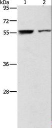 ARHGAP15 Antibody - Western blot analysis of Jurkat and 293T cell, using ARHGAP15 Polyclonal Antibody at dilution of 1:500.