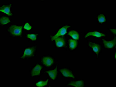 ARHGAP15 Antibody - Immunofluorescence staining of A549 cells diluted at 1:200, counter-stained with DAPI. The cells were fixed in 4% formaldehyde, permeabilized using 0.2% Triton X-100 and blocked in 10% normal Goat Serum. The cells were then incubated with the antibody overnight at 4°C.The Secondary antibody was Alexa Fluor 488-congugated AffiniPure Goat Anti-Rabbit IgG (H+L).