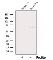 ARHGAP15 Antibody - Western blot analysis of extracts of human liver tissue using ARHGAP15 antibody. The lane on the left was treated with blocking peptide.