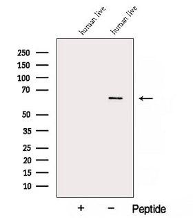 ARHGAP15 Antibody - Western blot analysis of extracts of human liver tissue using ARHGAP15 antibody. The lane on the left was treated with blocking peptide.