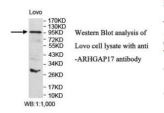 ARHGAP17 / NADRIN Antibody