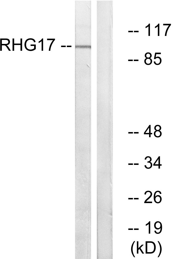 ARHGAP17 / NADRIN Antibody - Western blot analysis of lysates from LOVO cells, using RHG17 Antibody. The lane on the right is blocked with the synthesized peptide.