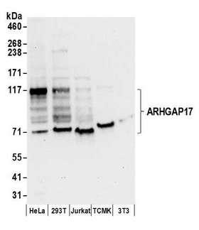 ARHGAP17 / NADRIN Antibody - Detection of human and mouse ARHGAP17 by western blot. Samples: Whole cell lysate (50 µg) from HeLa, HEK293T, Jurkat, mouse TCMK-1, and mouse NIH 3T3 cells prepared using NETN lysis buffer. Antibodies: Affinity purified rabbit anti-ARHGAP17 antibody used for WB at 0.1 µg/ml. Detection: Chemiluminescence with an exposure time of 10 seconds.