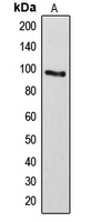 ARHGAP17 / NADRIN Antibody - Western blot analysis of ARHGAP17 expression in Lovo (A) whole cell lysates.