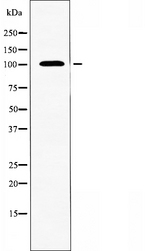 ARHGAP17 / NADRIN Antibody - Western blot analysis of extracts of LOVO cells using RHG17 antibody.