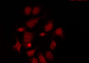 ARHGAP17 / NADRIN Antibody - Staining LOVO cells by IF/ICC. The samples were fixed with PFA and permeabilized in 0.1% Triton X-100, then blocked in 10% serum for 45 min at 25°C. The primary antibody was diluted at 1:200 and incubated with the sample for 1 hour at 37°C. An Alexa Fluor 594 conjugated goat anti-rabbit IgG (H+L) Ab, diluted at 1/600, was used as the secondary antibody.