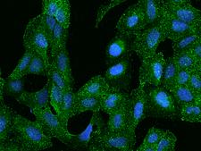 ARHGAP17 / NADRIN Antibody - Immunofluorescence staining of ARHGAP17 in U2OS cells. Cells were fixed with 4% PFA, permeabilzed with 0.1% Triton X-100 in PBS, blocked with 10% serum, and incubated with rabbit anti-Human ARHGAP17 polyclonal antibody (dilution ratio 1:100) at 4°C overnight. Then cells were stained with the Alexa Fluor 488-conjugated Goat Anti-rabbit IgG secondary antibody (green) and counterstained with DAPI (blue). Positive staining was localized to Cytoplasm.