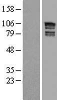 ARHGAP17 / NADRIN Protein - Western validation with an anti-DDK antibody * L: Control HEK293 lysate R: Over-expression lysate