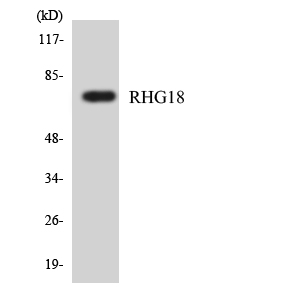 ARHGAP18 Antibody - Western blot analysis of the lysates from HepG2 cells using RHG18 antibody.
