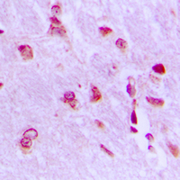 ARHGAP18 Antibody - Immunohistochemical analysis of ARHGAP18 staining in human brain formalin fixed paraffin embedded tissue section. The section was pre-treated using heat mediated antigen retrieval with sodium citrate buffer (pH 6.0). The section was then incubated with the antibody at room temperature and detected using an HRP conjugated compact polymer system. DAB was used as the chromogen. The section was then counterstained with hematoxylin and mounted with DPX.