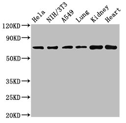 ARHGAP18 Antibody - Positive Western Blot detected in Hela whole cell lysate, NIH/3T3 whole cell lysate, A549 whole cell lysate, Rat lung tissue, Rat kidney tissue, Mouse heart tissue. All lanes: ARHGAP18 antibody at 4.5 µg/ml Secondary Goat polyclonal to rabbit IgG at 1/50000 dilution. Predicted band size: 75, 71 KDa. Observed band size: 75 KDa