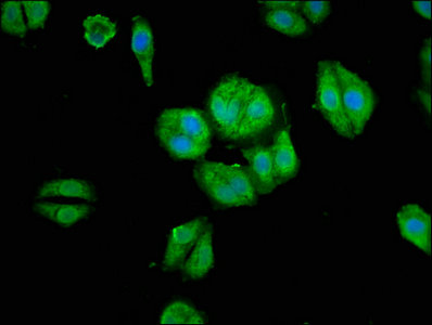 ARHGAP18 Antibody - Immunofluorescence staining of HepG2 cells with ARHGAP18 Antibody at 1:66, counter-stained with DAPI. The cells were fixed in 4% formaldehyde, permeabilized using 0.2% Triton X-100 and blocked in 10% normal Goat Serum. The cells were then incubated with the antibody overnight at 4°C. The secondary antibody was Alexa Fluor 488-congugated AffiniPure Goat Anti-Rabbit IgG(H+L).