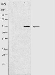 ARHGAP18 Antibody - Western blot analysis of extracts of 293 cells using RHG18 antibody. The lane on the left is treated with the antigen-specific peptide.