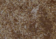 ARHGAP18 Antibody - 1:100 staining rat spleen tissue by IHC-P. The sample was formaldehyde fixed and a heat mediated antigen retrieval step in citrate buffer was performed. The sample was then blocked and incubated with the antibody for 1.5 hours at 22°C. An HRP conjugated goat anti-rabbit antibody was used as the secondary.
