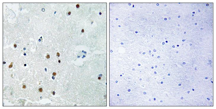 ARHGAP18 Antibody - Peptide - + Immunohistochemistry analysis of paraffin-embedded human brain tissue, using RHG18 antibody.