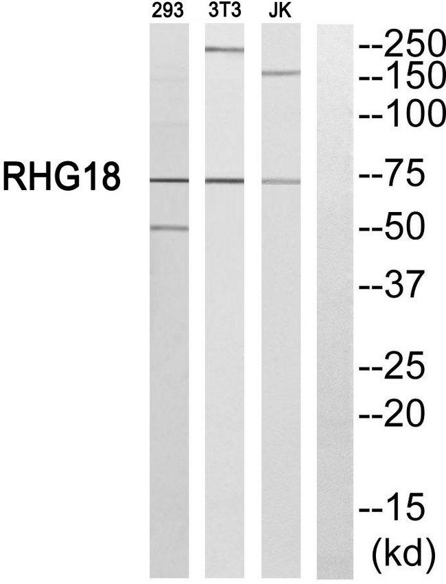 ARHGAP18 Antibody - Western blot analysis of extracts from 293 cells, NIH/3T3 cells and JurKat cells, using RHG18 antibody.