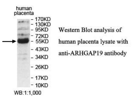 ARHGAP19 Antibody - Western blot of ARHGAP19 antibody