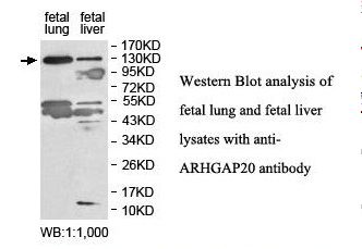 ARHGAP20 Antibody