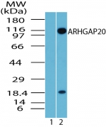 ARHGAP20 Antibody - Western blot of ARHGAP20 in rat brain lysate. Lane 1 shows pre-immune sera. Lane 2 shows antibody tested at 8 ug/ml.