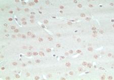 ARHGAP20 Antibody - IHC of mouse brain using Rho GTPase activating protein at 5 ug/ml.