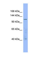 ARHGAP20 Antibody - ARHGAP20 antibody Western blot of 721_B cell lysate. This image was taken for the unconjugated form of this product. Other forms have not been tested.