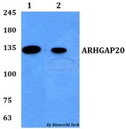 ARHGAP20 Antibody - Western blot of ARHGAP20 antibody at 1:500 dilution. Lane 1: A549 whole cell lysate. Lane 2: PC12 whole cell lysate.