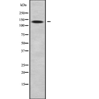 ARHGAP20 Antibody - Western blot analysis of RHG20 using HeLa whole cells lysates