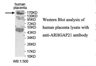 ARHGAP21 Antibody