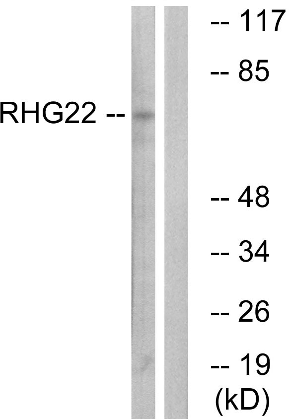 ARHGAP22 / RhoGAP2 Antibody - Western blot analysis of lysates from K562 cells, using RHG22 Antibody. The lane on the right is blocked with the synthesized peptide.