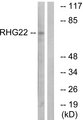 ARHGAP22 / RhoGAP2 Antibody - Western blot analysis of lysates from K562 cells, using RHG22 Antibody. The lane on the right is blocked with the synthesized peptide.