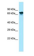 ARHGAP22 / RhoGAP2 Antibody - ARHGAP22 / RhoGAP2 antibody Western Blot of Fetal Kidney.  This image was taken for the unconjugated form of this product. Other forms have not been tested.