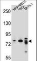 ARHGAP22 / RhoGAP2 Antibody - ARHGAP22 Antibody western blot of MDA-MB231,WiDr,ZR-75-1 cell line lysates (35 ug/lane). The ARHGAP22 antibody detected the ARHGAP22 protein (arrow).