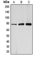 ARHGAP22 / RhoGAP2 Antibody - Western blot analysis of ARHGAP22 expression in HeLa (A); mouse kidney (B); rat kidney (C) whole cell lysates.
