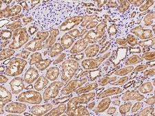 ARHGAP22 / RhoGAP2 Antibody - Immunochemical staining of human ARHGAP22 in human kidney with rabbit polyclonal antibody at 1:100 dilution, formalin-fixed paraffin embedded sections.