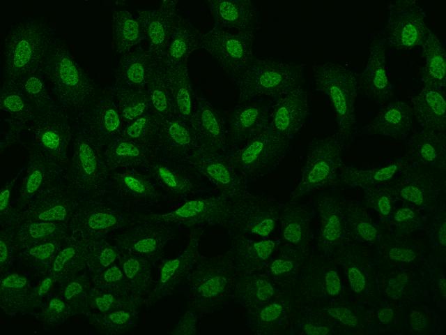 ARHGAP22 / RhoGAP2 Antibody - Immunofluorescence staining of ARHGAP22 in U2OS cells. Cells were fixed with 4% PFA, permeabilzed with 0.1% Triton X-100 in PBS, blocked with 10% serum, and incubated with rabbit anti-Human ARHGAP22 polyclonal antibody (dilution ratio 1:100) at 4°C overnight. Then cells were stained with the Alexa Fluor 488-conjugated Goat Anti-rabbit IgG secondary antibody (green). Positive staining was localized to Nucleus.