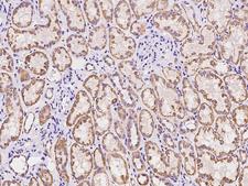 ARHGAP22 / RhoGAP2 Antibody - Immunochemical staining of human ARHGAP22 in human kidney with rabbit polyclonal antibody at 1:100 dilution, formalin-fixed paraffin embedded sections.