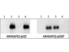 ARHGAP22 / RhoGAP2 Antibody - Western Blot of Rabbit anti-ARHGAP22 pS22 antibody. Lane 1: NIH3T3 cells transfected with a null vector. Lane 2: NIH3T3 cells transfected with ARHGAP22. Lane 3: NIH3T3 cells transfected with ARHGAP22 S22 to alanine mutation. Lane 4: NIH3T3 cells transfected with ARHGAP22 S397 to alanine mutaion. Primary antibody: Left: ARHGAP22 pS22, Right: ARHGAP22 pS397 antibody at 1µg/mL for overnight at 4°C. Secondary antibody: IRDye800™ rabbit secondary antibody at 1:10,000 for 45 min at RT.