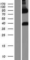 ARHGAP22 / RhoGAP2 Protein - Western validation with an anti-DDK antibody * L: Control HEK293 lysate R: Over-expression lysate